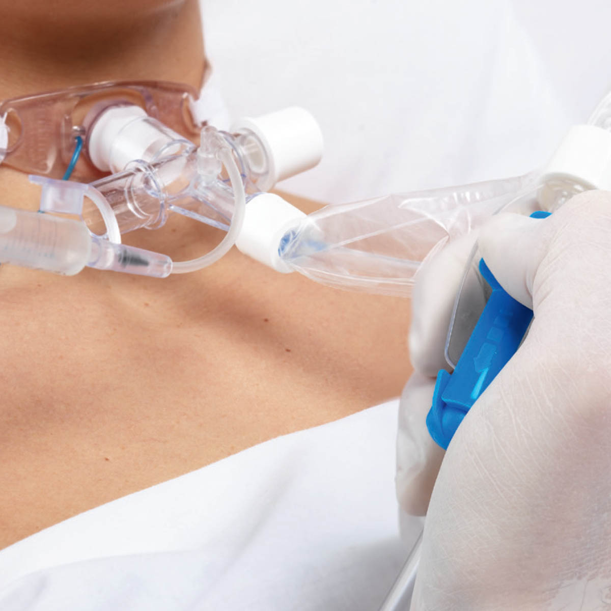 medcorp_smiths-medical-suctionPro72-sistema-fechado-de-aspiracao-5