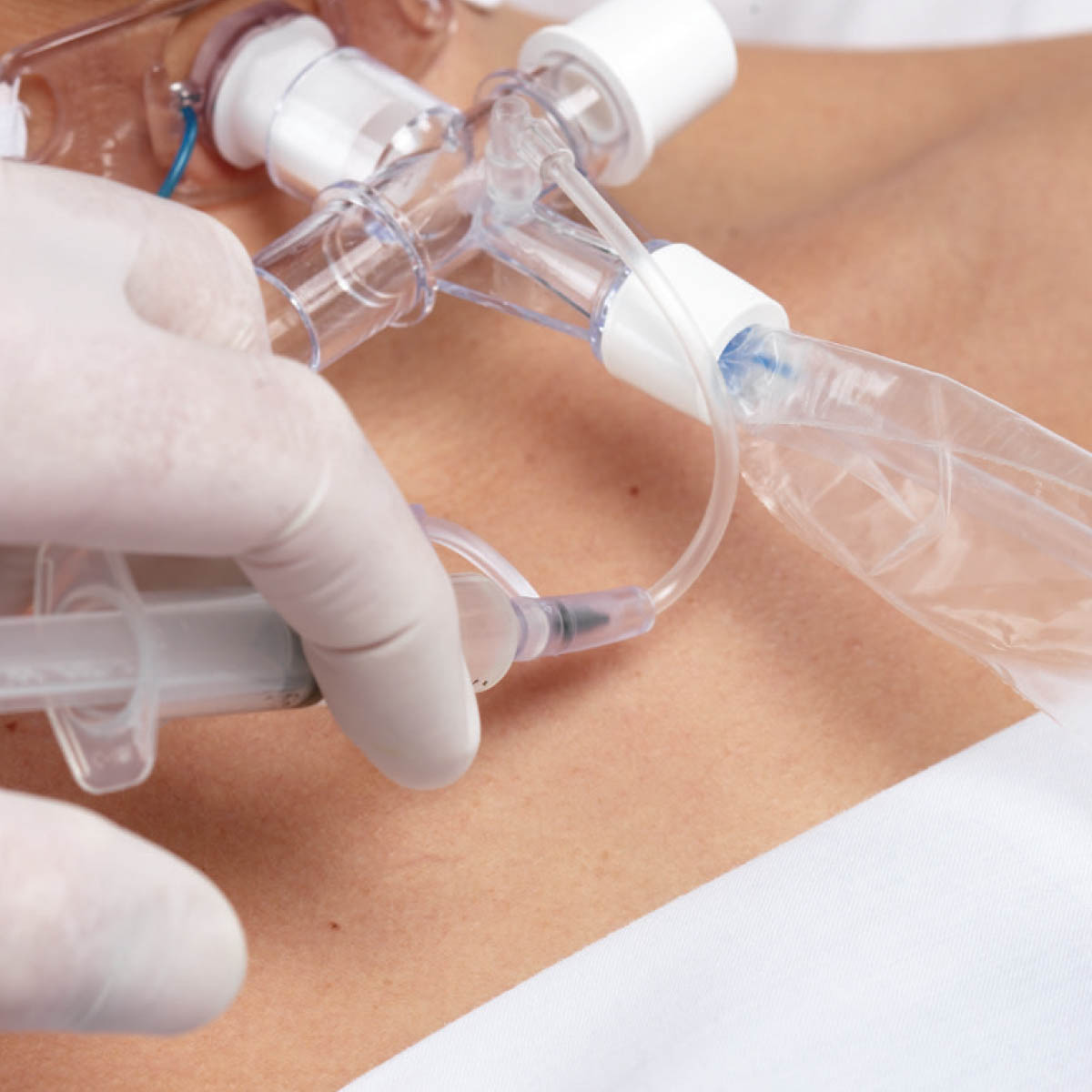 medcorp_smiths-medical-suctionPro72-sistema-fechado-de-aspiracao-7